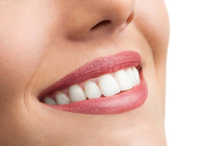 dental crowns orlando fl blend seamlessly with natural teeth