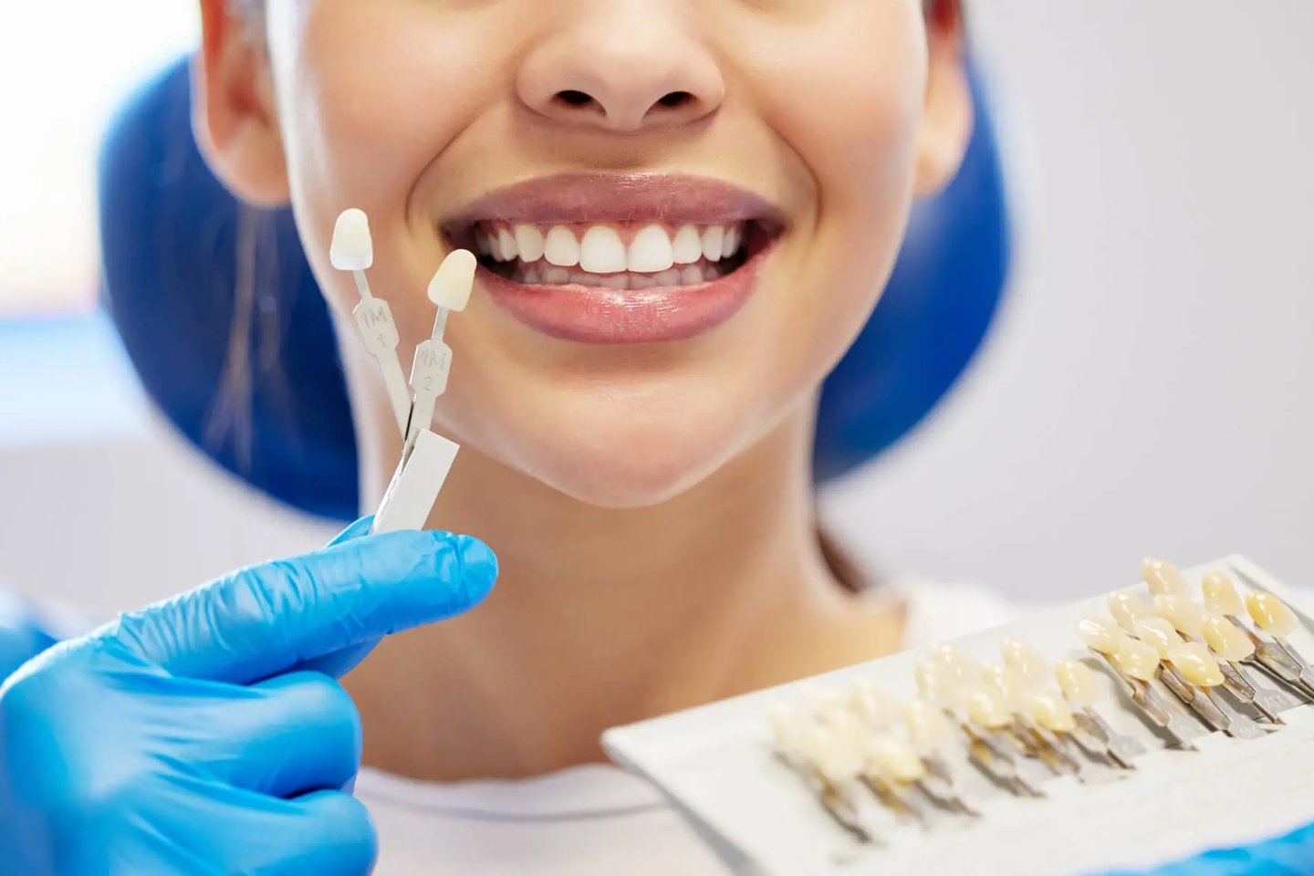 Cosmetic Dentist in Winter Park That Offers Veneers