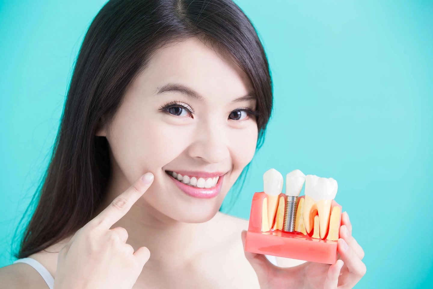 Girl smiling with dental implants winter park fl