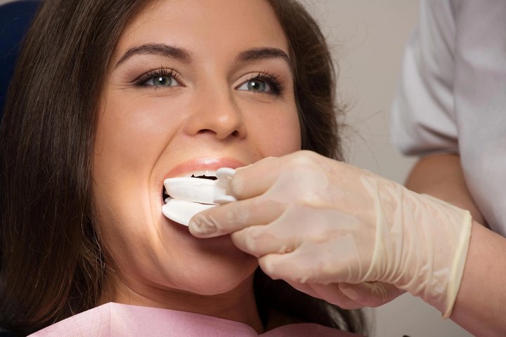 How Does Opalescence™ Teeth Whitening Work?