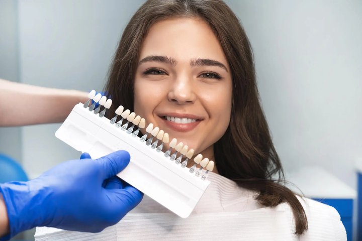 Factors-That-Affect-The-Longevity-of-the-Best-Veneers-in-Orlando