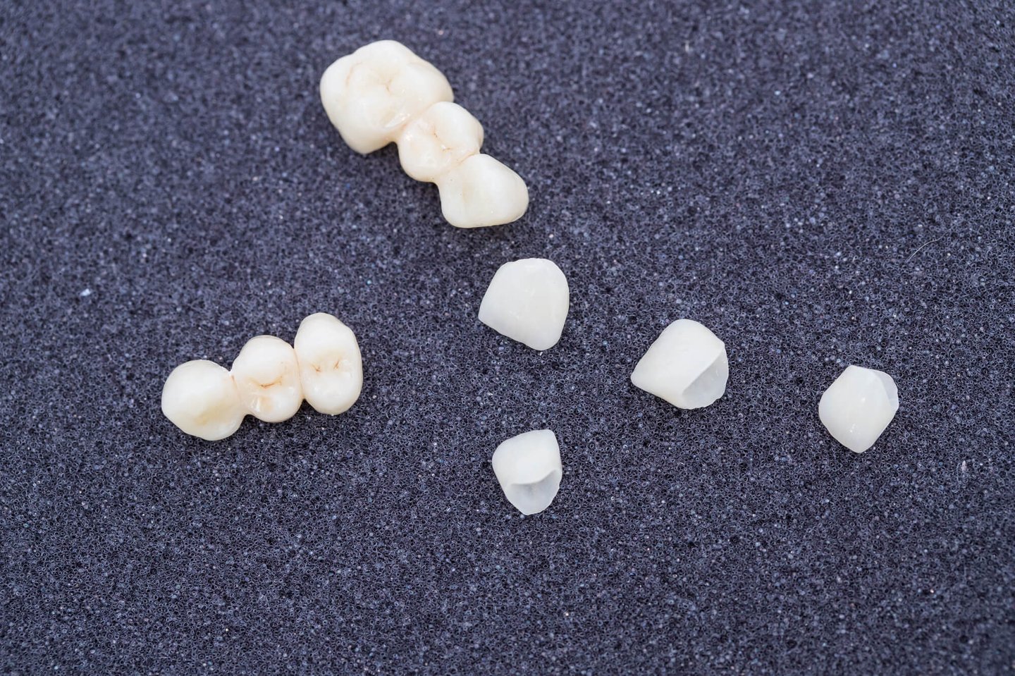 dental crowns orlando fl