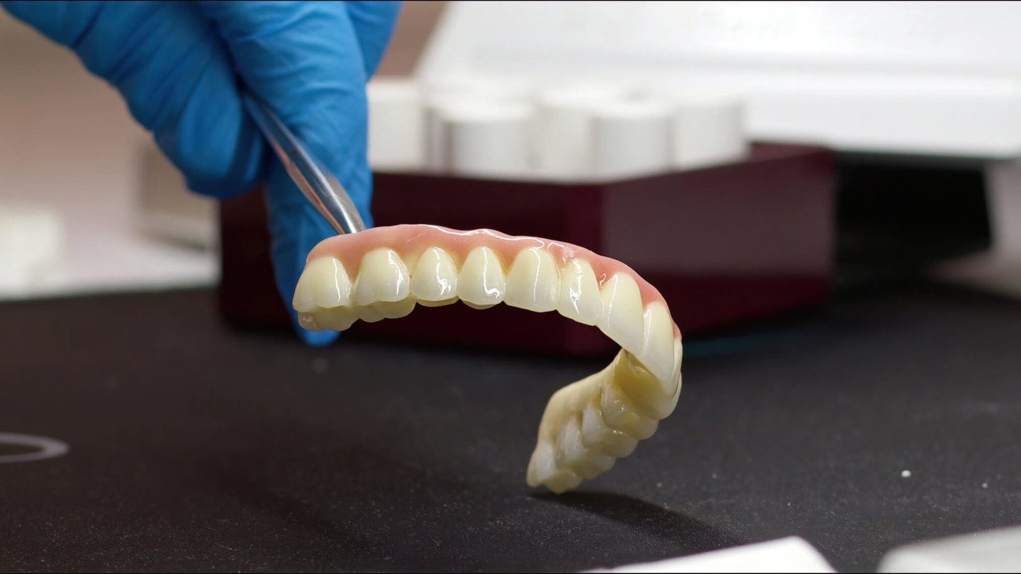 Are You a Candidate for All-on-4® Dental Implants in Winter Park FL