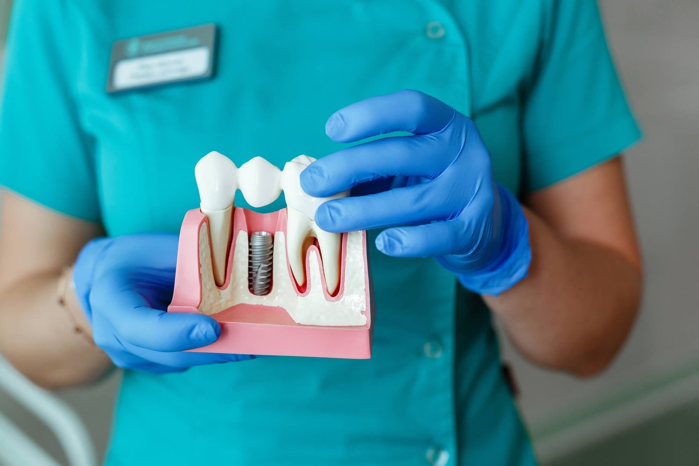 dentist in winter park holding a model of a dental implant