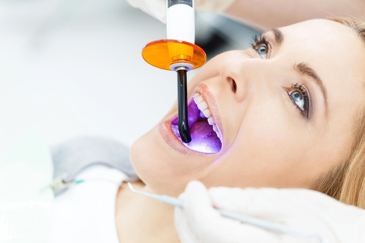 ongoing park dental teeth whitening