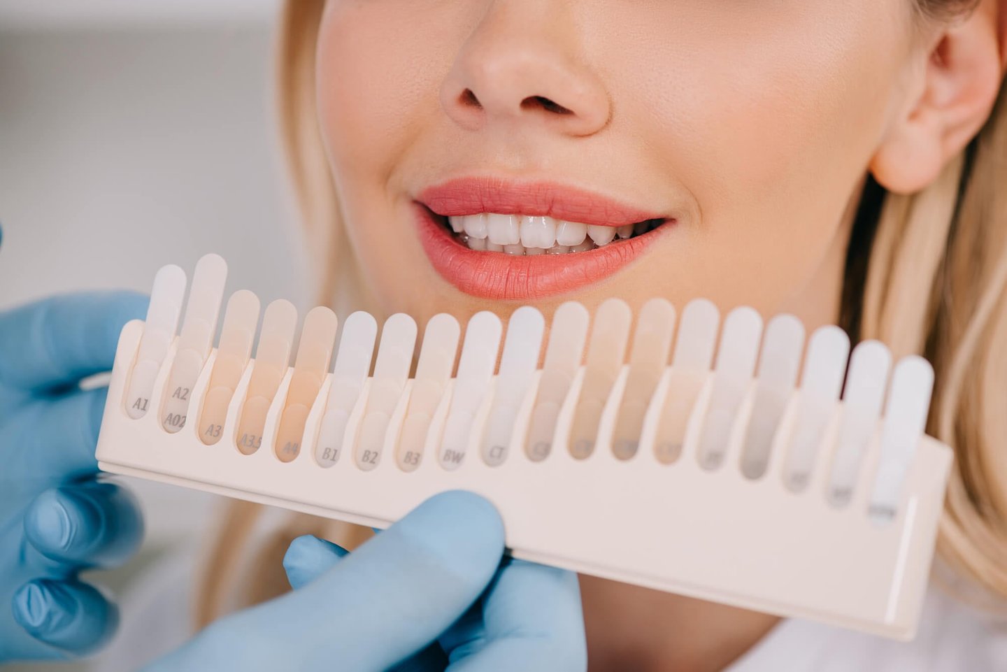 patient choosing shade for teeth whitening winter park