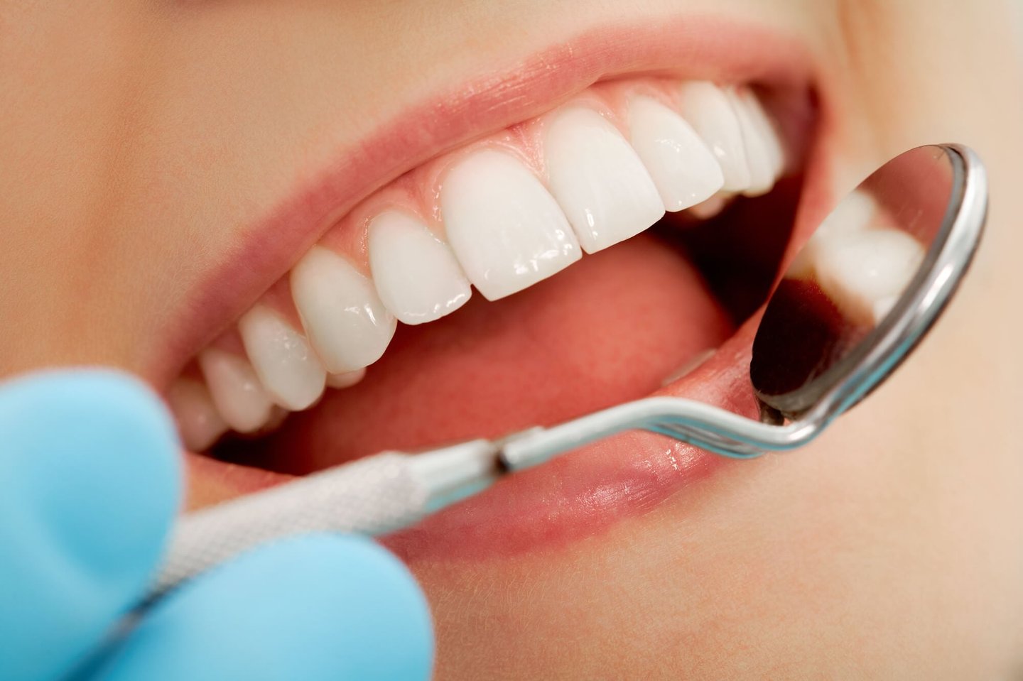 cosmetic dentist winter park checks patient's teeth