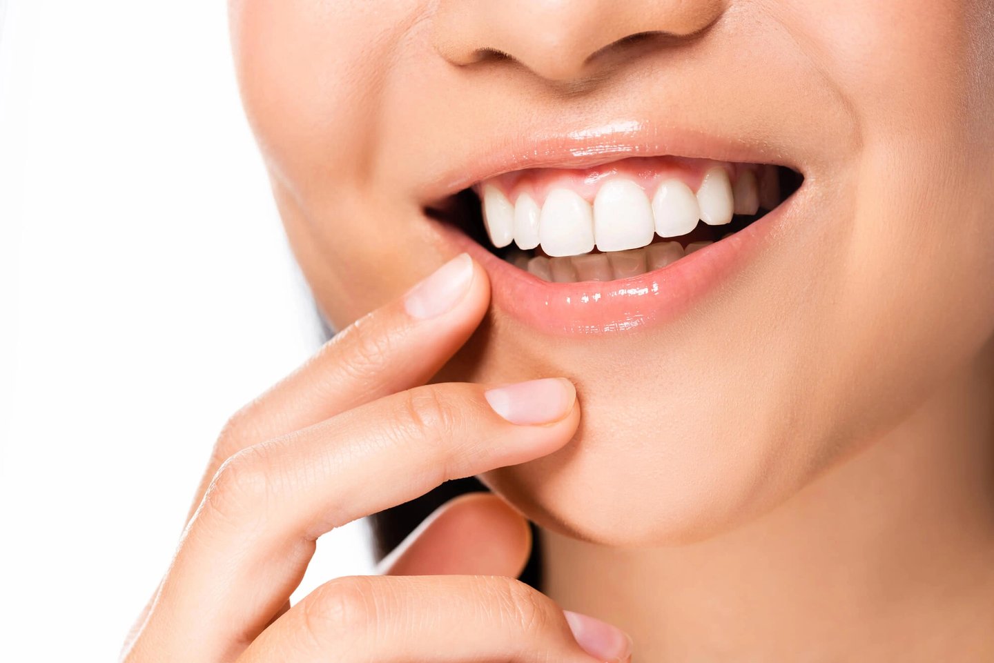 Girl smiling with veneers winter park