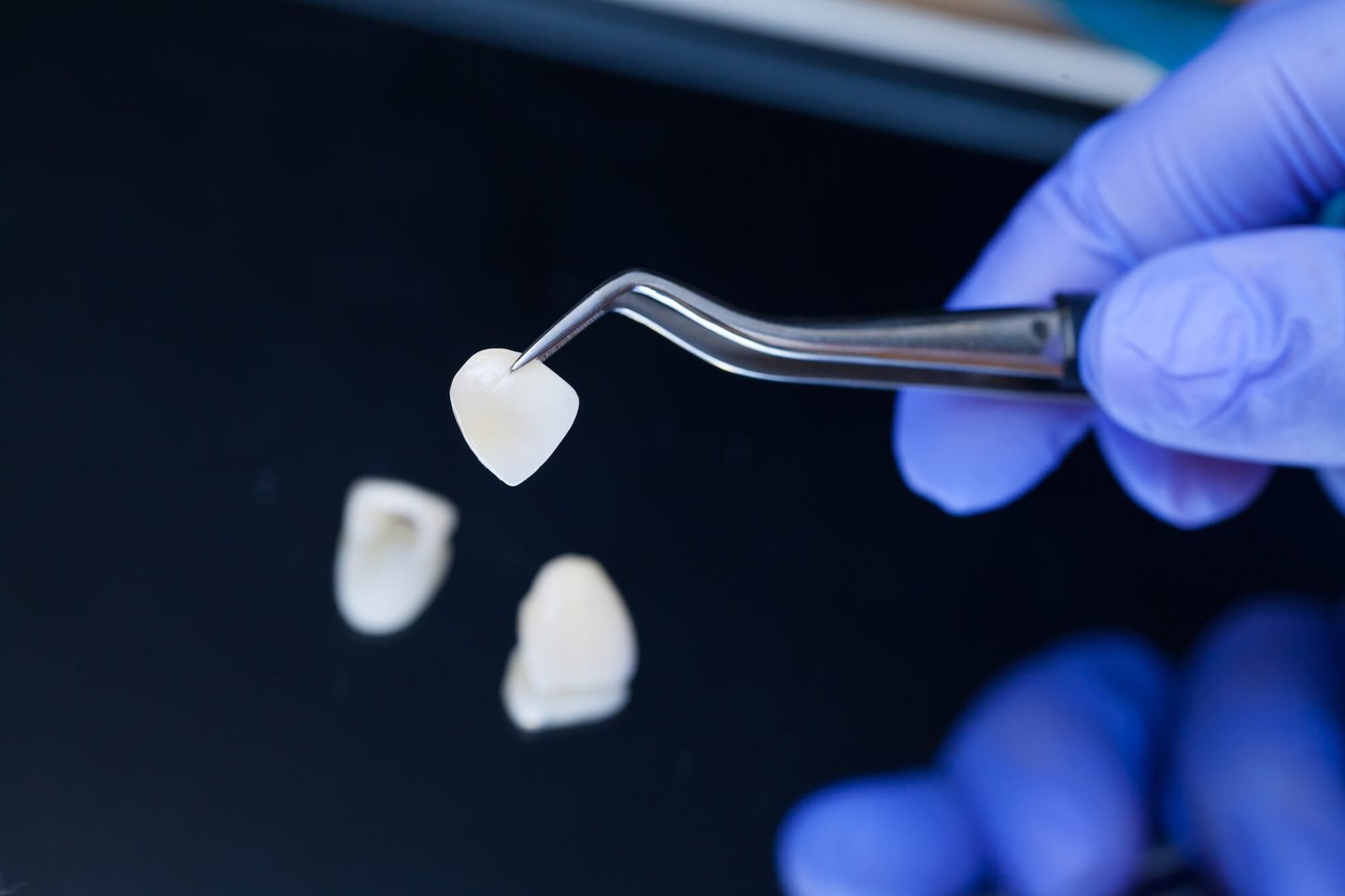 cosmetic dentist picking up the best veneers in orlando