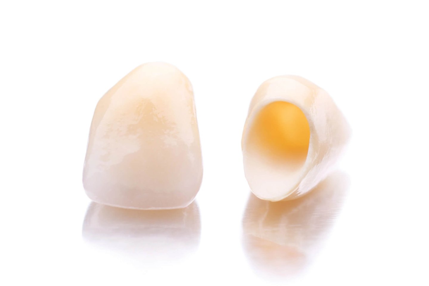 dental crowns winter park