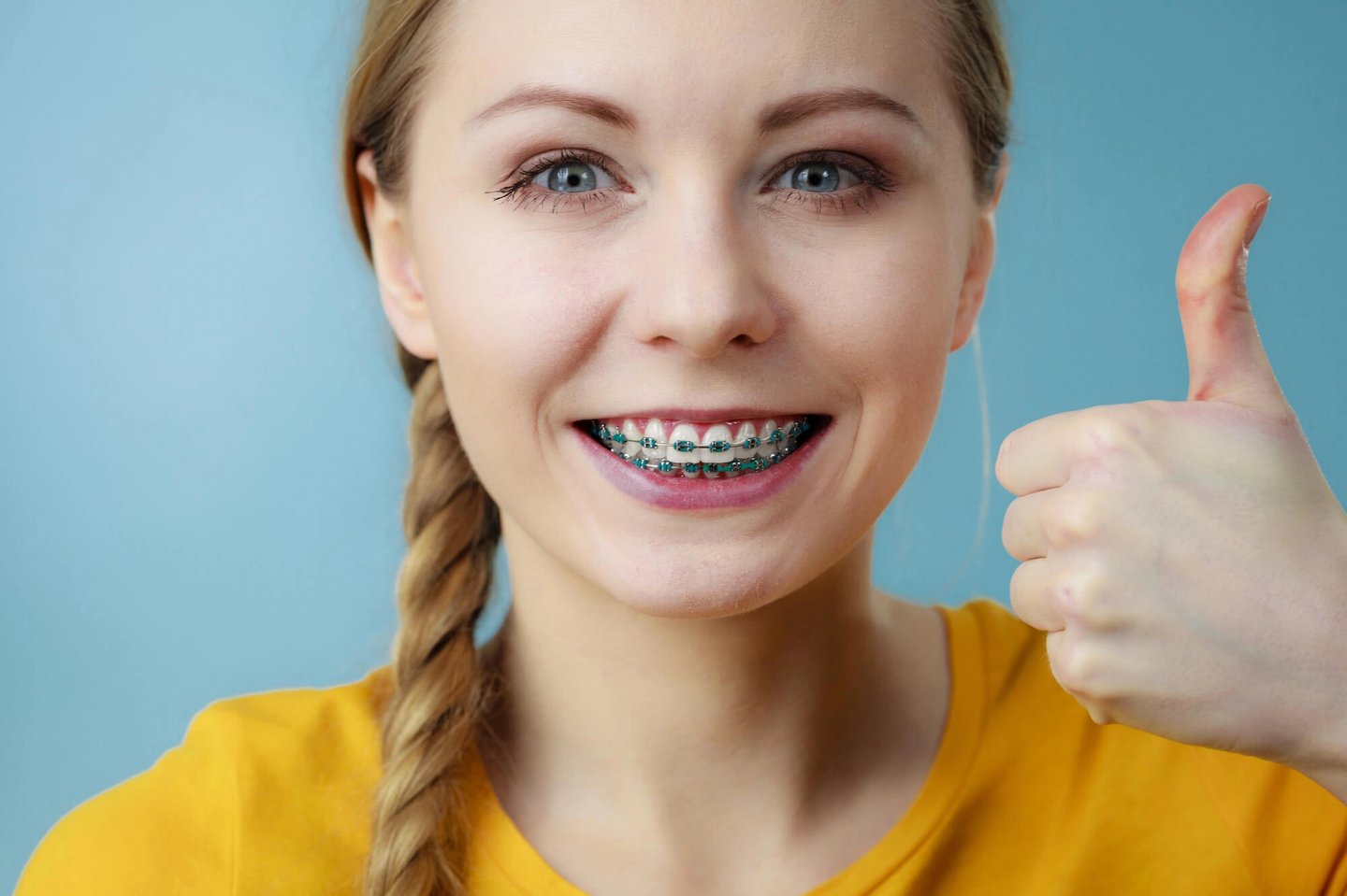 winter park fl invisalign or braces