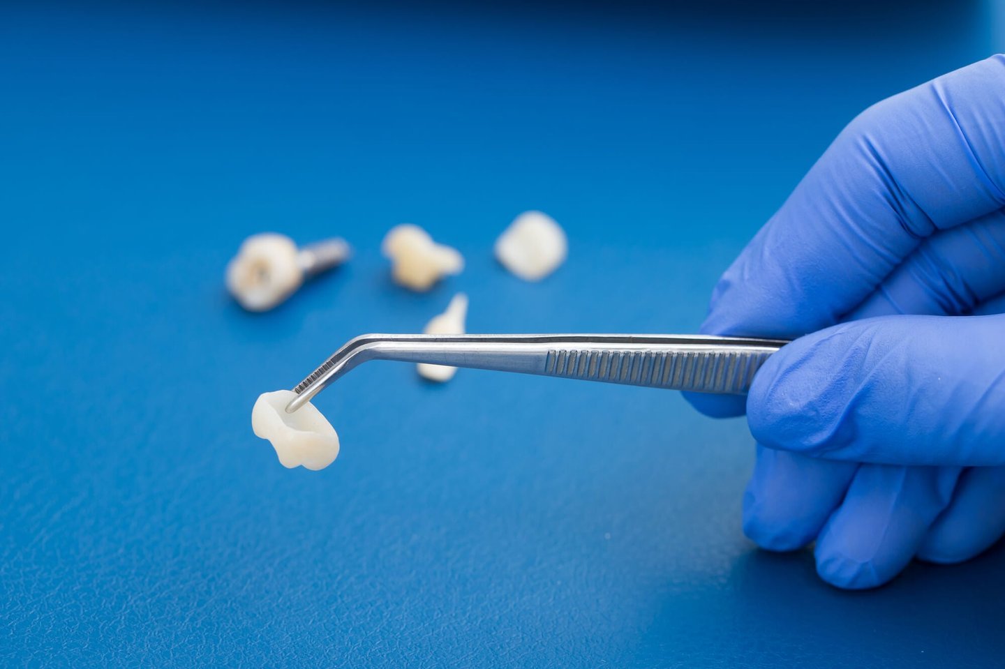a dentist checks dental crowns in orlando fl 
