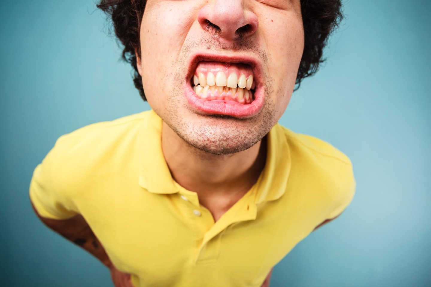 man showing his yellow teeth needs park dental teeth whitening