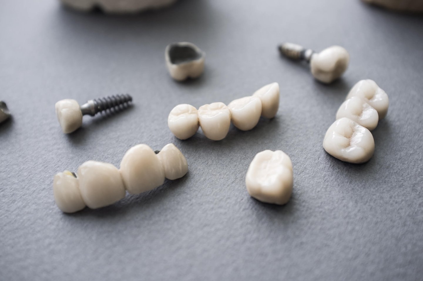 full mouth restoration includes dental implants