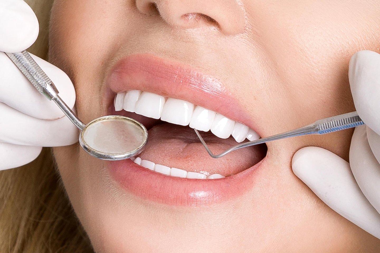 cosmetic dentist examining patient's porcelain veneers orlando fl