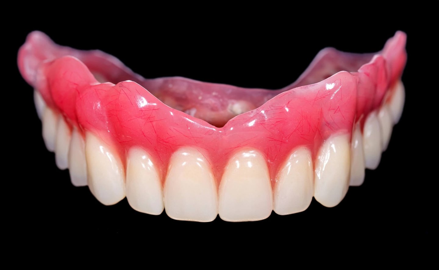 dentists in winter park fl show a sample of dentures