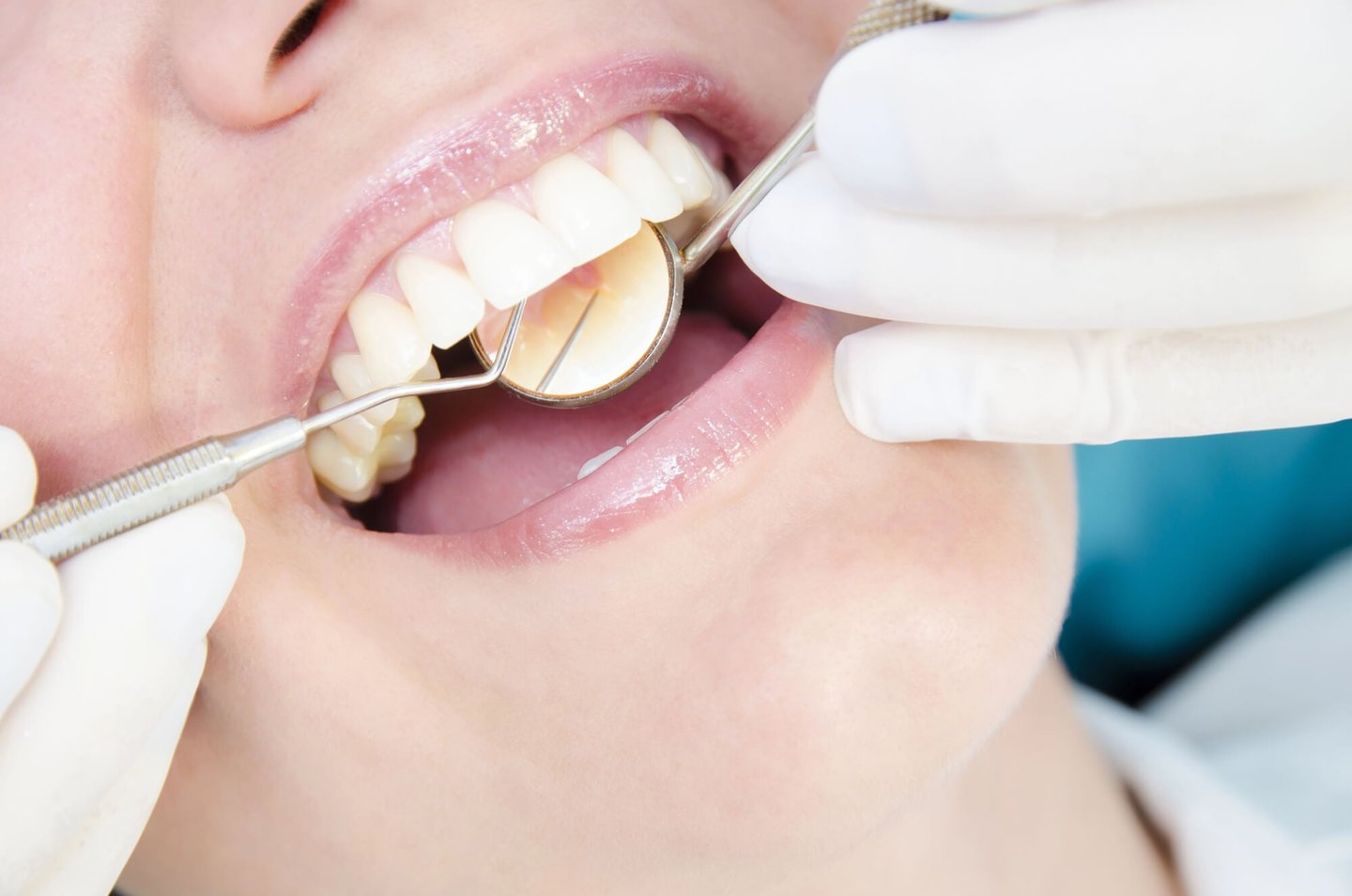dentists in winter park fl performing dental exam