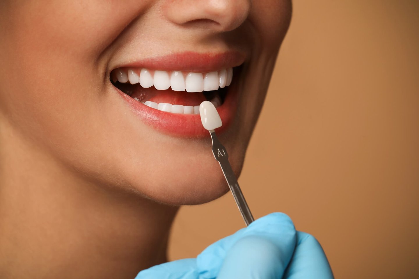 patient excited for her new veneers winter park