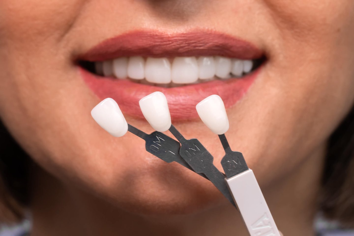 choosing a shade for porcelain veneers orlando fl