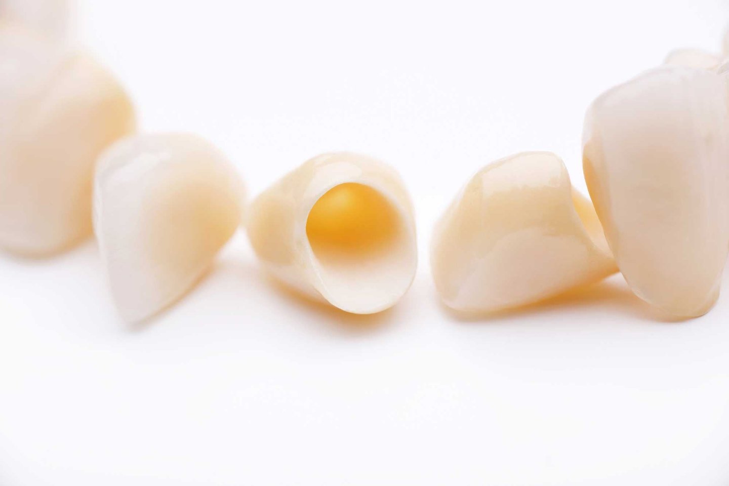 Issues and Concerns About Dental Crowns