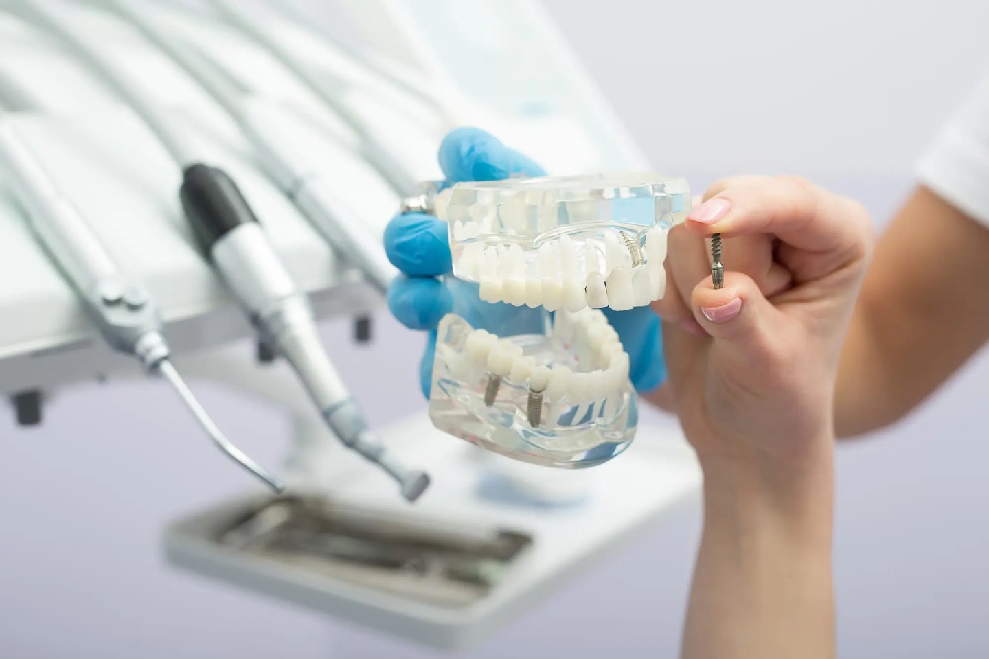 Dental implant teeth model