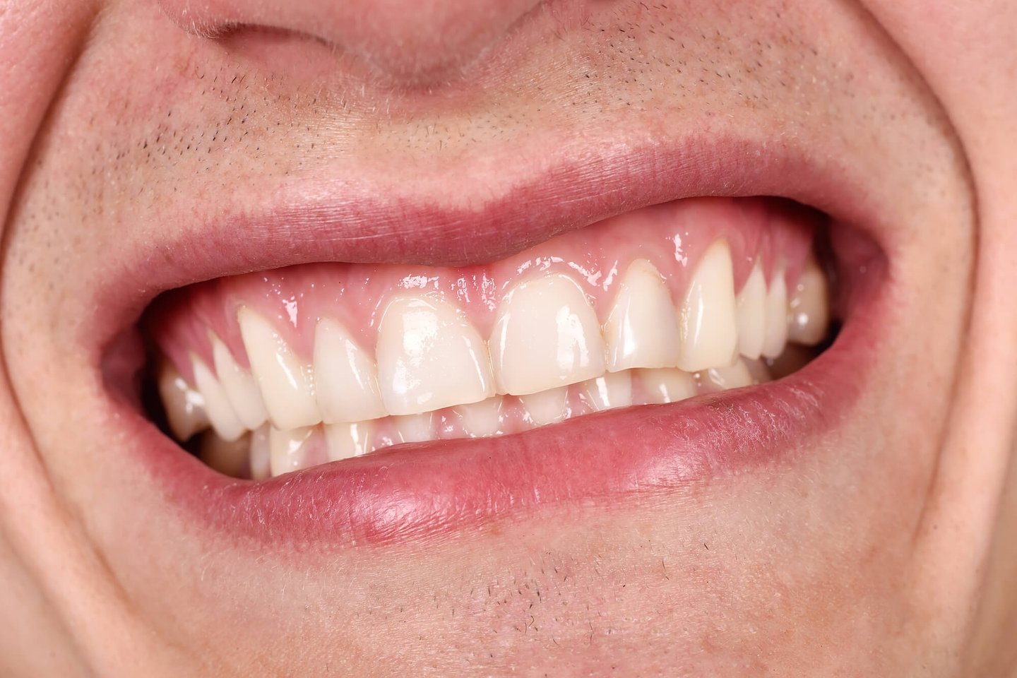 patient smiles for the dentist in Winter Park