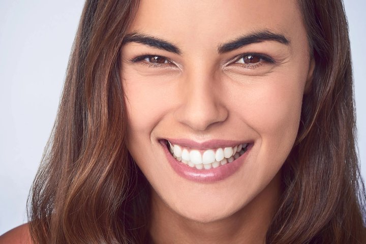 Girl-showing-off-the-best-veneers-in-orlando