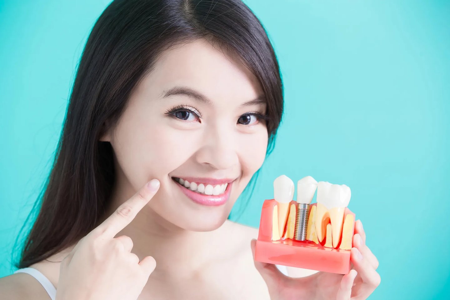 Girl showing off her dental implants Orlando FL