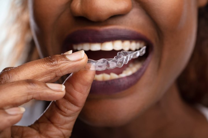 woman puts on Winter Park, FL Invisalign