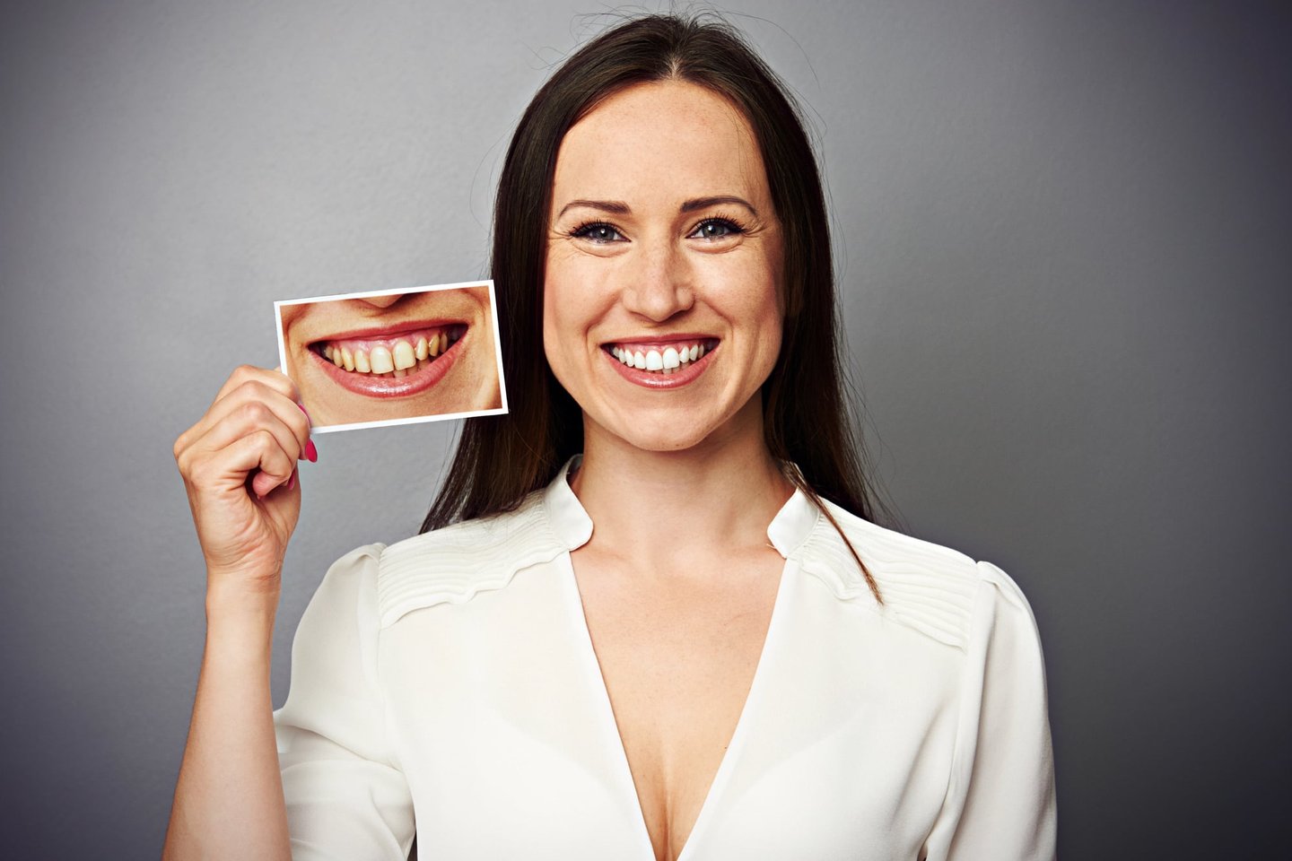 woman showing before and after of teeth whitening in winter park