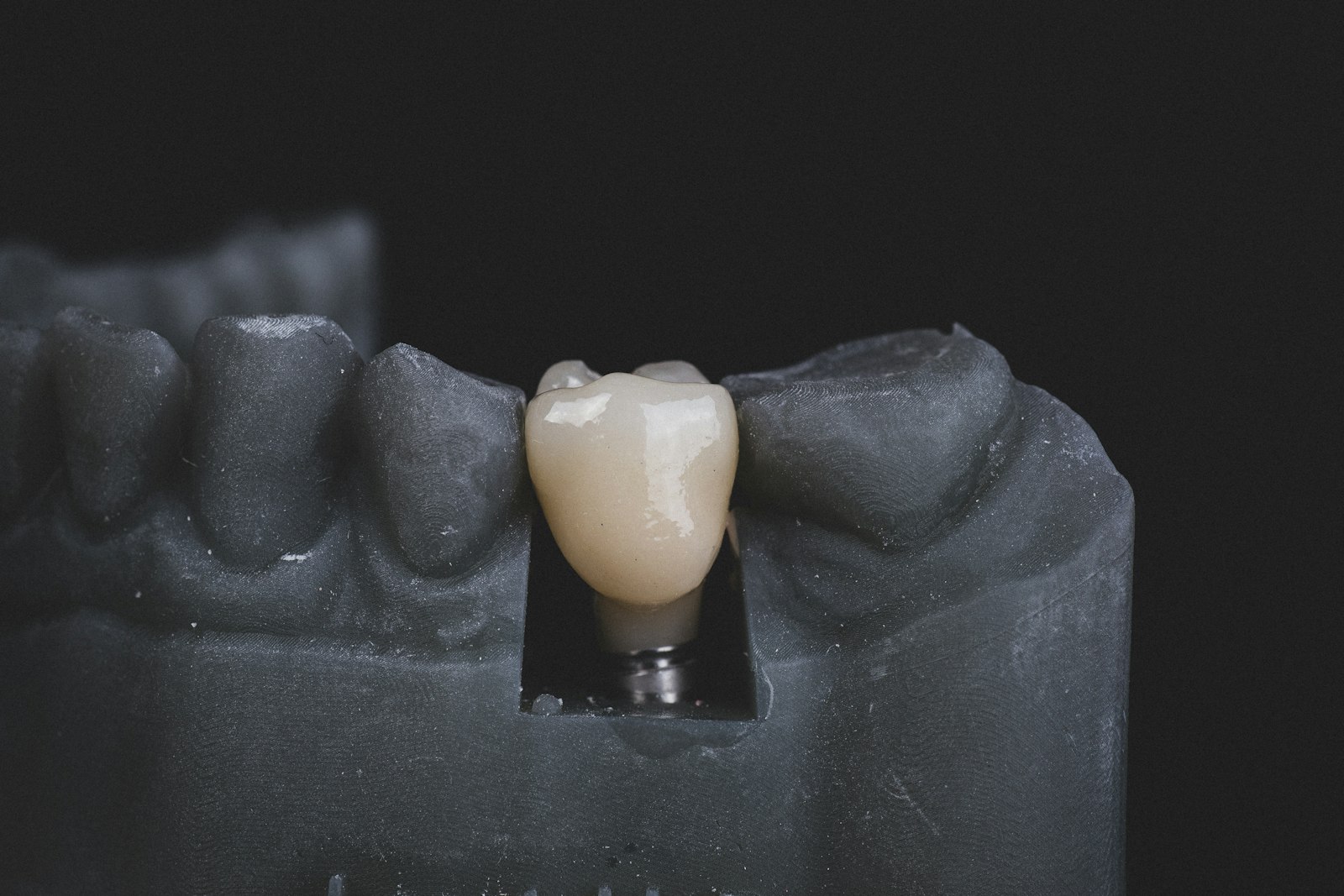 Same-Day Dental Crowns
