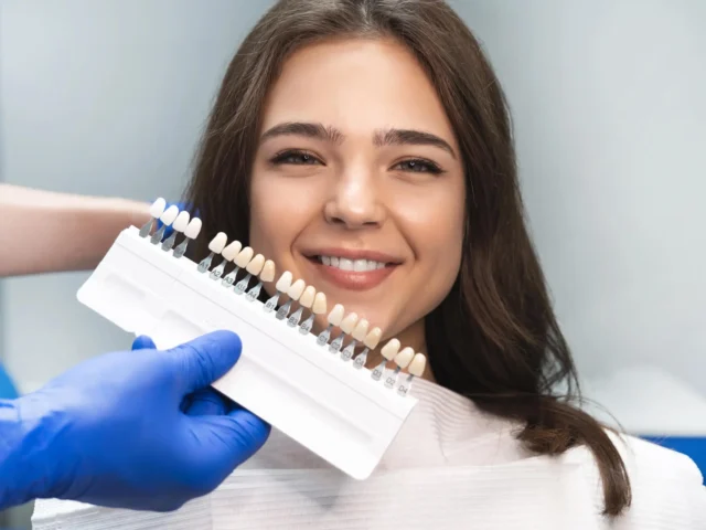 How Long Do Veneers Last?
