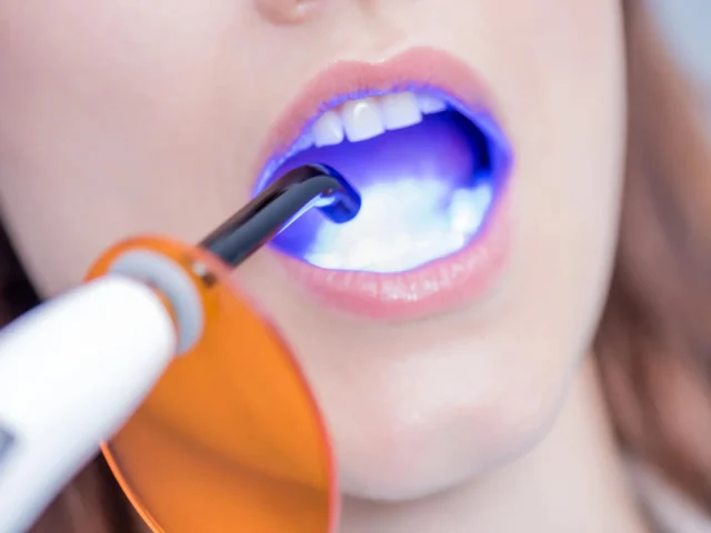 Dos and Don'ts After a Teeth Whitening Procedure