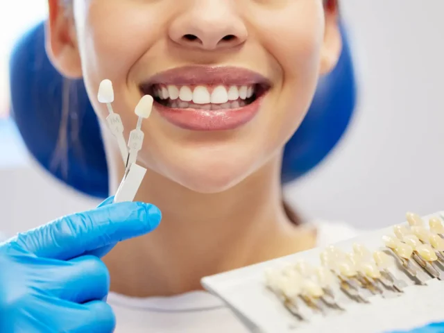 Can I Get Veneers If I Clench My Teeth?