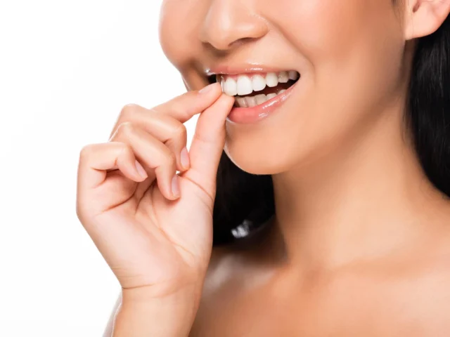 How Veneers Can Fix Chips, Gaps, and Stains Without Major Work
