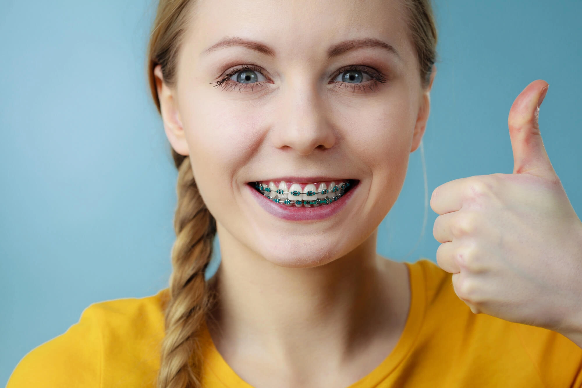 winter park fl invisalign or braces