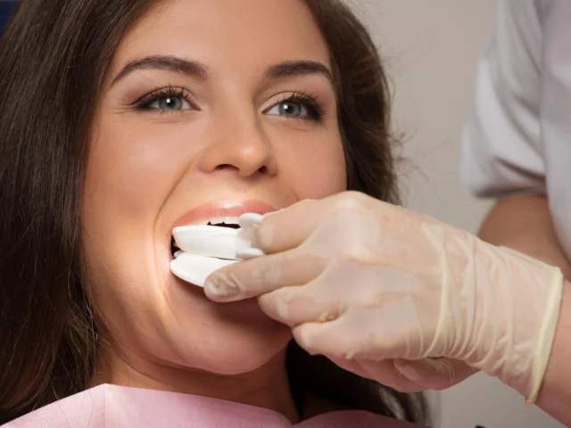 How Does Opalescence™ Teeth Whitening Work?