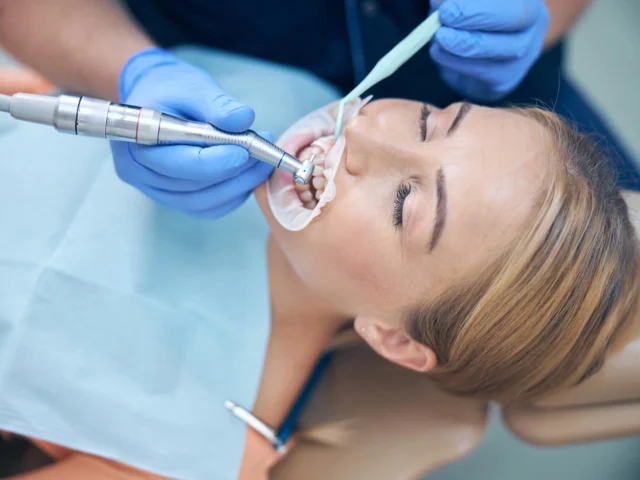 Everything You Need to Know About Same-Day Dental Crowns
