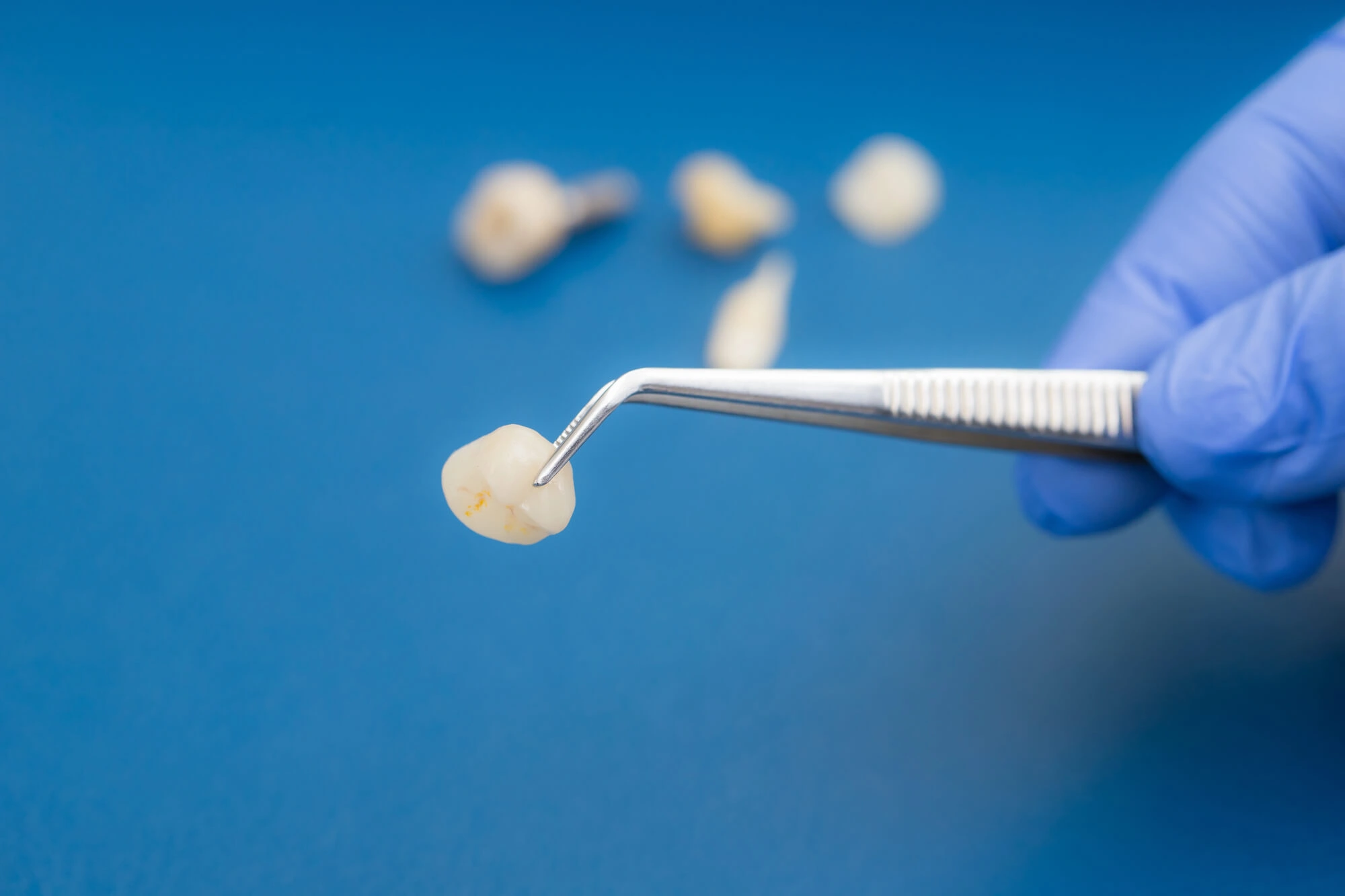 dental crowns winter park