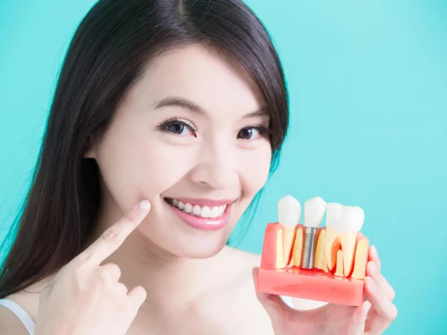 How Dental Implants Help Preserve Jawbone Health