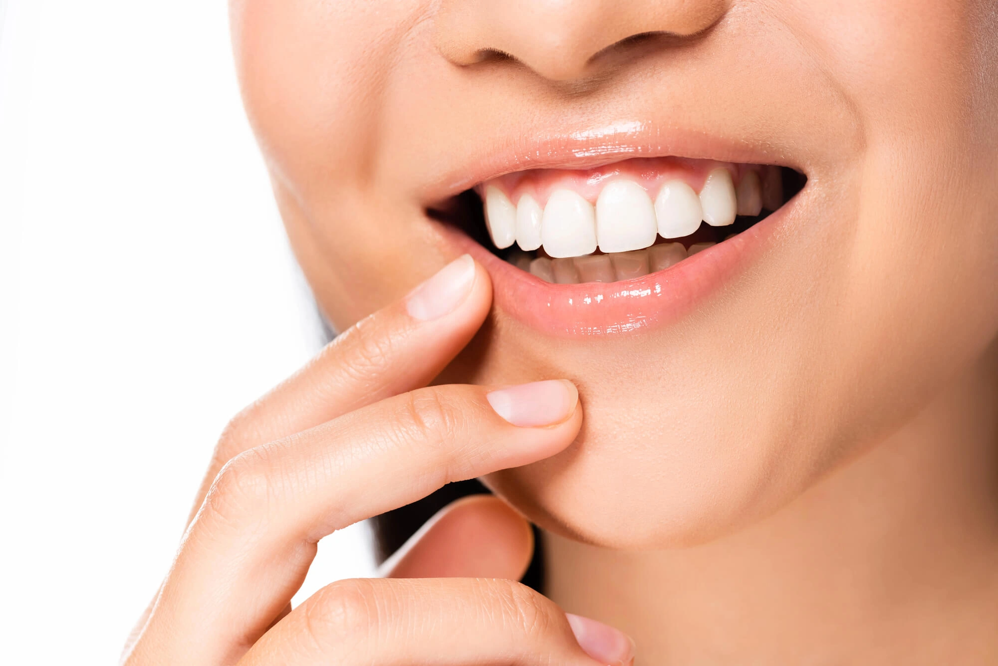 Girl smiling with veneers winter park